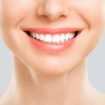Some Methods Of Teeth Whitening